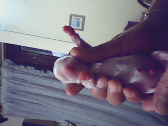 Picture